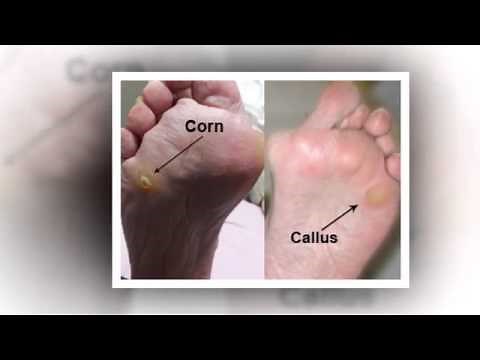 Chiropodist - Home Visit Chiropodist