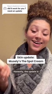 Finally fade your “melasma mustache” and regain your confidence with The Spot Cream! ✨ Treat dark spots, sun damage, acne scars, and age spots with gold-standard ingredients: • Hydroquinone • Niacinamide • Azelaic Acid • Tretinoin (M formula only) #melasma #melasmamustache #melasmatreatment #thespotcream #spotcream #darkspots | Musely