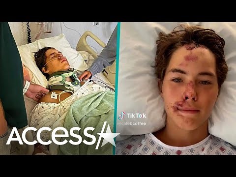 TikTok Star Caleb Coffee Survives 60-Foot Fall Off Of Cliff In Hawaii