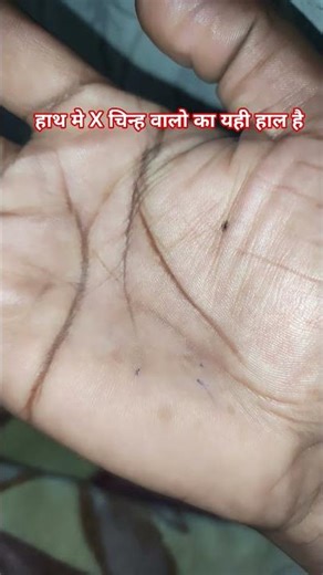 हाथ मे X चिन्ह वालो का यही हाल है #X #fyp #xn #xways #xhashtag #xsquad #xsession #xevent #xportal