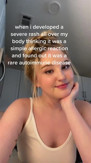 Understanding Dermatomyositis: Symptoms, Causes, and Treatment Options