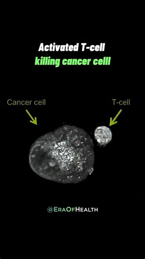 Mind | Body | Longevity on Instagram: "Your body is doing this right now - without you feeling a thing. This real-time footage shows a T-cell locking onto a cancer cell, puncturing its membrane, and triggering cell death. No drugs. No surgery. Just immune intelligence doing what it was designed to do. T cells are part of your immune surveillance system. They constantly scan for abnormal cells, infected cells, and early cancer changes, then eliminate them before they spread. When immune function 