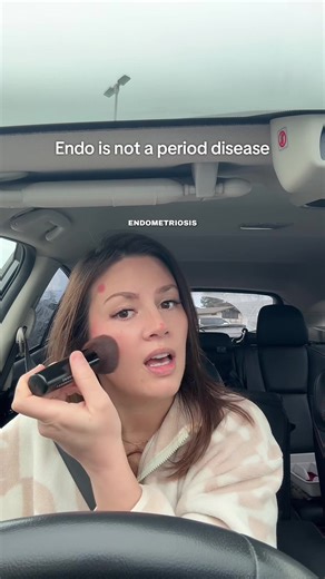 The fun never ends… endometriosis has caused my sphincter to not communicate with my brain, which has now given me hemorrhoids and fissures 😩 No idea what I would do without my pelvic floor therapist 🪽 #endometriosis #constipation #pelvicfloor #womenshealth