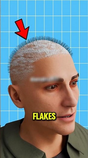 Stop Scratching Your Scalp… This Is What Those White Flakes Really Mean 😳