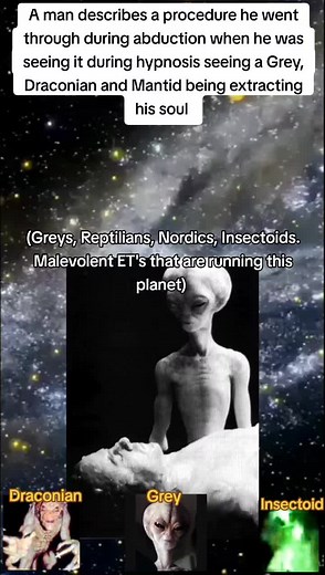 A man describes a procedure he went through during abduction when he was seeing it during hypnosis seeing a Grey, Draconian and Mantid being extracting his soul 🛸👽 #aliens #uap #ufo #fyp #greys #reptilian #nordics #insectoid