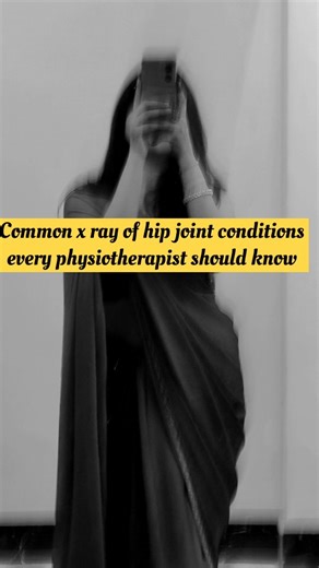 Flex n Heal🏋️🏃 on Instagram: "Hip pain starts with understanding what the X-ray shows. Learn these basic signs in just a few seconds..... #__thephysioverse__ #futurephysio #painrelief #ᴛʀᴇɴᴅɪɴɢᴘᴏsᴛ #foryou #rehabilitation #physiotherapy #evidencebasedpractice #foryoupage💙 #physio #physiotherapy"