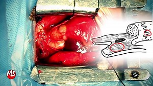 This video explains in less than 3 minutes, the structural organization of cardiac muscle that is required for a co-ordinated myocardial contraction. | Medical Snippet