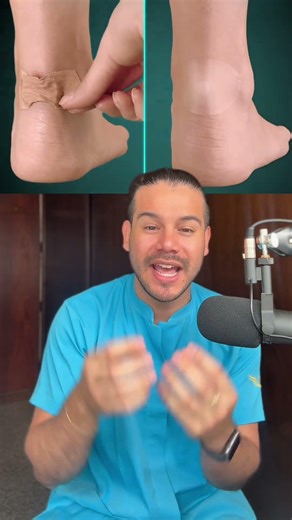 USE OF COMPEED ON THE FEET #podiatry