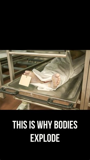 Why Bodies Explode After Death | Stage 1 Explained