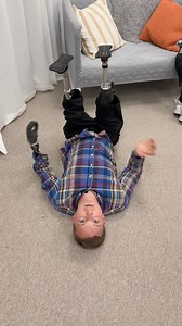 Five reasons why I use stubbies as a bilateral above knee amputee! 🦿 #prosthetics #stubbies #prosthesis #tripleamputee #abovekneeamputee | Christoffer Lindhe - Triple Amputee