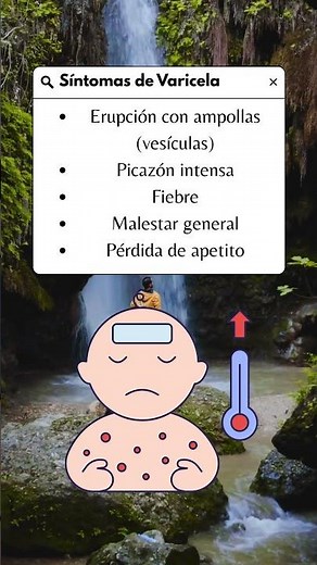 Síntomas de varicela #sintomas #varicela #medicina #salud