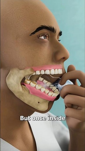 light bulb stuck in mouth 😱 #doctor #facts