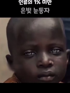 전세계 1% 미만의 희귀한 회색 눈동자