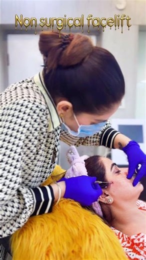 Facelift with COG THREADS stays upto 1yr to 1.5yrs with minimal downtime and minimal pain