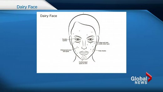 Dr. Nigma Talib: Reverse the Signs of Ageing