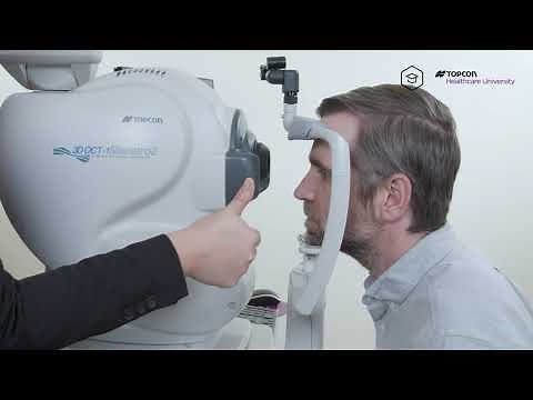 How to Capture a Radial Anterior Segment Scan on my Topcon Maestro2