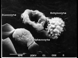 Scanning Electron Microscope images of the Discocyte-Echinocyte Transformation of Red Blood Cells