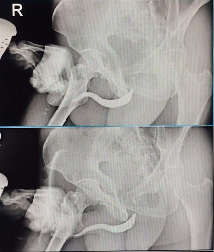 X-ray RGU #medical #radiology #xray #viral #trending #shorts