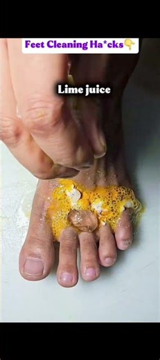 Feet Cleaning Hack at Home 👣 Easy Tips | Health Hype #shorts #feethacks