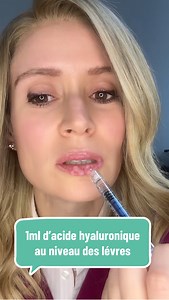 31K views · 283 reactions |  1 ml d’acide hyaluronique lèvres, c’est...