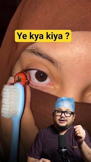 Don't Try This Contact Lens Hack ⚠️