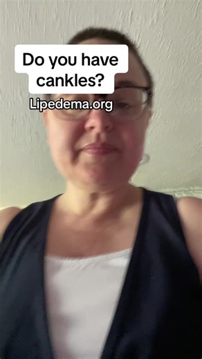 #cankles