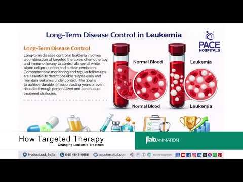 How Targeted Therapy Is Changing Leukemia Treatment