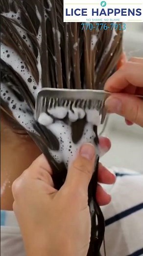 How to Check & Treat Head Lice Fast | Quick Lice Removal Tips