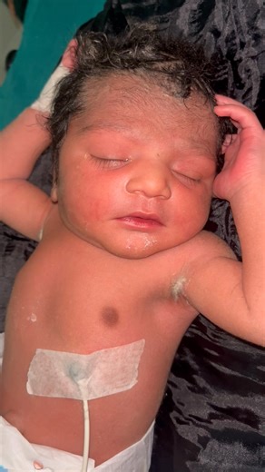 Baby delivery normal baby weight 2.9kg 🥰 #baby #babybirth #nicubaby #birth #nicu | Docter Inderpal