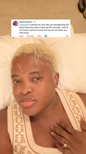 I did sessions of acupuncture, and was healed within a month, but not completely, that’s why I went back again, for another session. | AngieNation