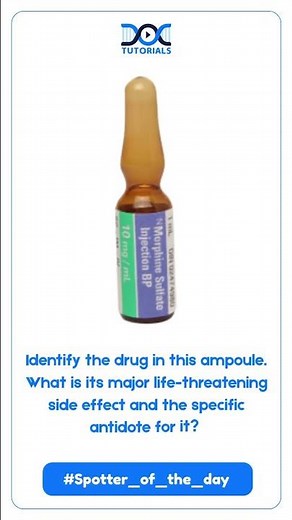 Spotter of the Day | DocTutorials MBBS