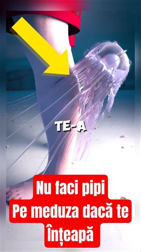 Nu face PIPI pe rană dacă te înțeapă o meduză! 😱🐙 Greșeala fatală de la plajă #primajutor