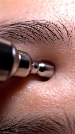Satisfying Pore Extraction 🌟 #ASMR #skincare #beauty