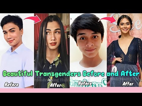 Beautiful Transgenders Before and After | Male to Female Transition | MTF Transition