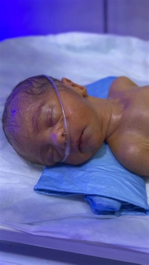2.9K views · 57 reactions | This is the emotional journey of a premature baby survival war in NICU. Every heartbeat, every feed, and every breath is a struggle for life. These tiny warriors fight harder than anyone can imagine. Please keep this little angel in your prayers for strength, health, and recovery. #NICUBaby​ #PrematureBaby​ #SurvivalWar​ #TinyFighter​ #NICUCare​ #BabyInNICU​ #PreemieStrong​ #CuteBaby​ #BabyRecovery​ #PrayForThisBaby | Nurse Life | Facebook