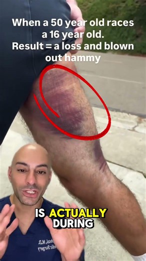 He Tore His Hamstring… So Why Is His Ankle Purple? 💀🩻