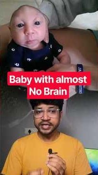 Boy had 80 percent of his brain missing