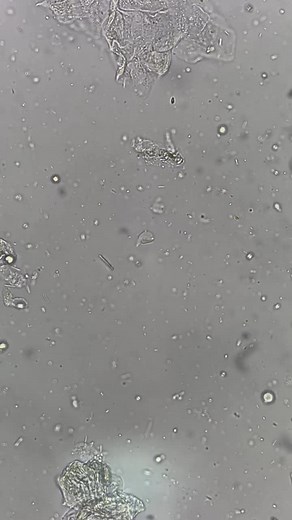 microscopic examination 🩺🥼🔬👀#fypppppppppppppp #fypシ゚ #4u