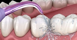 How To Use a Waterpik Water Flosser (Without Making a Mess) - Dentaly.org