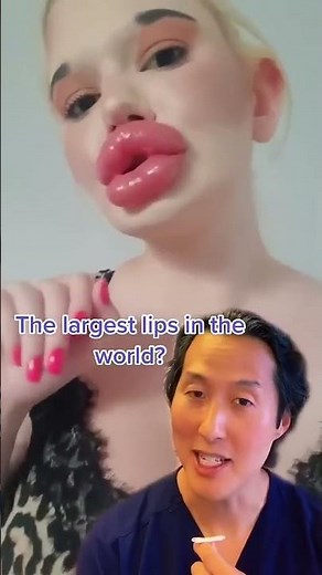 Are These the Largest Lips in the World?