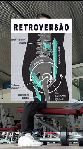 RETROVERSÃO x ANTEROVERSÃO nos exercícios de musculação. EXTRA: Nos movimentos de EMPURRAR, como um supino, press militar (desenvolvimento) etc, mais que uma anteroversão forçada, recomendo uma posiçã neutra do quadril, porém com o GLÚTEO em contração. EXTRA 2: Em relação a uma anteroversão “forçada”, o mesmo se aplica a um agachamento. Não recomendo que seja feita. Uma postura neutra é o que indico. Inclusive, uma leve retroversão pode preservar e não prejudicar a sua coluna lombar como muitos 