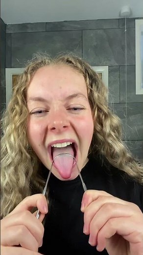 Smile therapy-tongue scraper