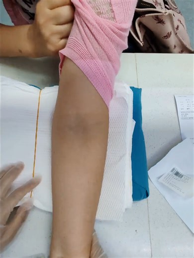 Mastering Vein Finding Techniques for Nurses