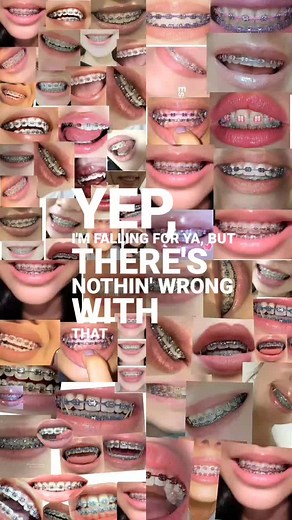 Understanding the Benefits of Braces for Teeth