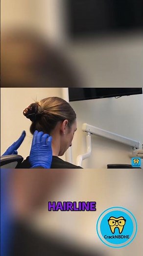 Identifying the Occipital Lymph Node: A Step-by-Step Guide - NBDHE Dental Hygiene Boards