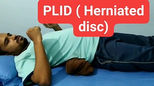 Home exercise for herniated disc (According to patient condition) A herniated disc (also called bulged, slipped or ruptured) is a fragment of the disc nucleus that is pushed out of the annulus, into the spinal canal through a tear or rupture in the annulus. Causes a herniated disk: Aging. Excessive weight. Repetitive motions. Sudden strain from improper lifting or twisting. | M.R Physiotherapy and Rehabilitation Center