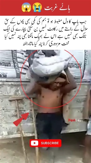 “One Leg, Infinite Courage | A Father’s Strength and Faith” #shorts #shortsviral #Infinite #courage