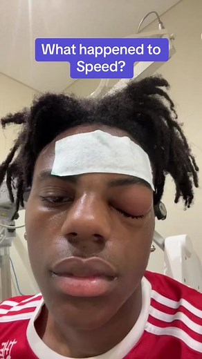 #stitch with @ishowspeed87 What happened to Speed? #ispeedshow #clusterheadache