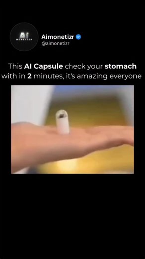 GLOBAL REEL HUB on Instagram: "AI Capsule check your stomach within 2 minutes...... A new AI-powered capsule endoscopy system can perform a stomach exam in as little as eight minutes. This technology has been highlighted in recent reports from China. Key Details Procedure Time: The process of swallowing the capsule and completing the stomach exam is reported to take approximately 8 minutes. The capsule then passes naturally through the digestive system over the next 24 hours or more. Technology: