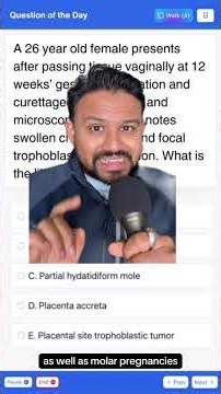 Molar pregnancies for the USMLE | HyGuru